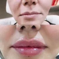 خدمات ژل و بوتاکس بانوان و آقایان|خدمات آرایشگری و زیبایی|پرند, فاز ۵|دیوار