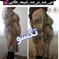 لاغری اصولی بدون رژیم و ورزش|آرایشی، بهداشتی، درمانی|خرمآباد, |دیوار