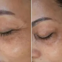 حراج کرم وی ای پی اصلی اورجینال