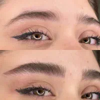 میکروبلیدینگ