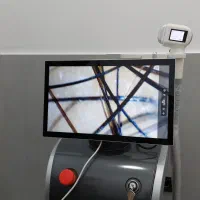 دستگاه لیزر مو زاید مولتی تک|پزشکی|کرج, عظیمیه|دیوار