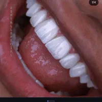 کلینیک دندانپزشکی هیوا