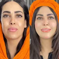 لیفت و جوانسازی صورت با ارزان ترین قیمت توسط پزشک|خدمات آرایشگری و زیبایی|مشهد, هنرستان|دیوار