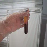 مرکز پی آر پی ،مزوتراپی ،سلول درمانی ،زانو،بوتاکس|خدمات آرایشگری و زیبایی|کرج, عظیمیه|دیوار