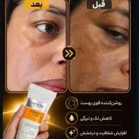 خداحافظی با لک و تیرگی با کرم ضدلک بیوممتیک گاتیو