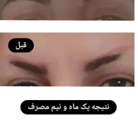 پوستتو با ما ترمیم کن|آرایشی، بهداشتی، درمانی|شیراز, ستارخان|دیوار