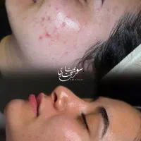 پاکسازی پوست و اسکالپ