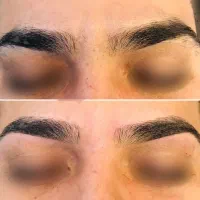 اصلاح تخصصی ابرو و صورت