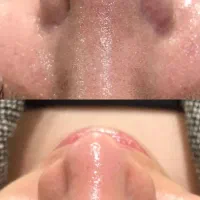 آف ویژه فیشیال‌تخصصی