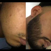 ریش فول، استایل ورزشکاری