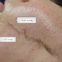 فیشیال (پاکسازی پوست) تخفیف ویژه|خدمات آرایشگری و زیبایی|رشت, رشتیان|دیوار