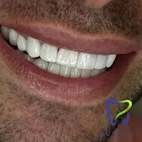 دندانپزشکی کامپوزیت و درمانی|خدمات آرایشگری و زیبایی|تهران, سلسبیل جنوبی|دیوار