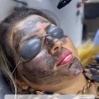 پاکسازی تخصصی صورت فیشیال هالیوودی