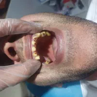 دندان سازی|خدمات آرایشگری و زیبایی|خوی, |دیوار