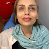 تزریق فیلر بوتاکس ،شرایط اقساط،اسنپ پی،ونک|خدمات زیبایی و سلامت|تهران, ونک|دیوار