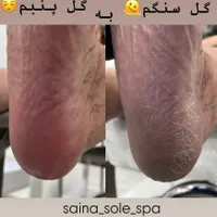مدل برای خدمات پدیکور ( فقط با هزینه مواد)