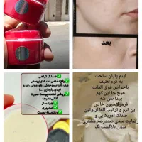 کرم همه کاره صورت و بدن. سوپرمعجزه