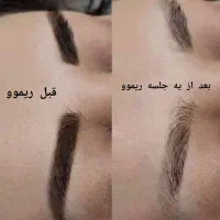 ریموو تتوهای قدیمی تک جلسه ای با آف ویژه|خدمات آرایشگری و زیبایی|شیراز, شهرک ولیعصر|دیوار