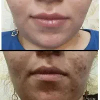 جوان سازی پوست خود را به ما بسپارید|آرایشی، بهداشتی، درمانی|اردبیل, |دیوار