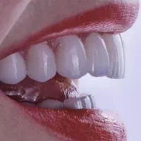 باعکسOPG،بیمه تکمیلی سامان ویاچک صیادی مراجعه کنید|خدمات آرایشگری و زیبایی|بم, |دیوار