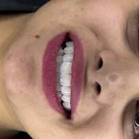 انجام کلیه خدمات دندانپزشکی و زیبایی