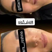 زل صورت|خدمات آرایشگری و زیبایی|بوئین زهرا, |دیوار