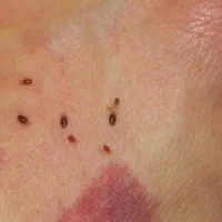 سمپاشی سوسک و ساس دریک مرحله صدرصد تضمینی|خدمات نظافت|تهران, پاسداران|دیوار