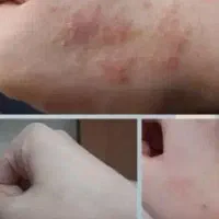 پاکسازی و جوانسازی پوست و صورت