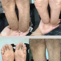 یه لحظه رد نکن بیا ببین پدیکور پارو|خدمات آرایشگری و زیبایی|محمدیه-قزوین, |دیوار