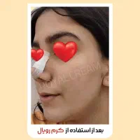 اگه دنبال پوست خوبی پیام بده|آرایشی، بهداشتی، درمانی|خلخال, |دیوار