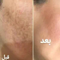 روشن کننده قوی