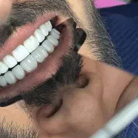 زیبایی دندان ..هر 8 واحد 10میلون