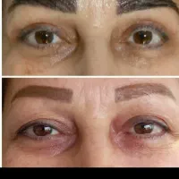 جشنواره پیکرتراشی ،لیپو و ابدو با تخفیف ویژه