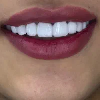 یلدا با تخفیف کامپوزیت