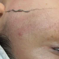 اصلاح تخصصی۱۰مرحله کلینیک پزشک ۱۴۸ تومان( بانوان)