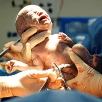 زنان زایمان مامایی پرستاری