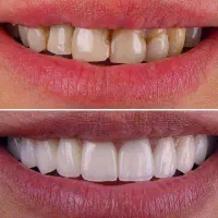 تخصص ما زیبایی دندان هاست|خدمات آرایشگری و زیبایی|انار, |دیوار