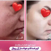 کرم ژل رویال صد در صد تضمینی|آرایشی، بهداشتی، درمانی|شیراز, حافظیه|دیوار