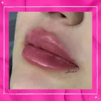 تخفیفات 50% دکتر کاظمی، بوتاکس فیلر مزو ژل لب روسی|خدمات آرایشگری و زیبایی|مشهد, احمدآباد|دیوار