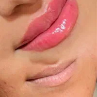 تخفیف ویژه ژل و بوتاکس|خدمات آرایشگری و زیبایی|گنبد کاووس, |دیوار