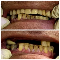 دندانپزشکی دیجیتال و طراحی لبخند اقساط|خدمات آرایشگری و زیبایی|رشت, دروازه لاکان|دیوار
