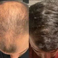 ورود افراد زیر بیست سال ممنوع