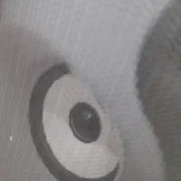 نوبت گوارش و آندوسکوپی