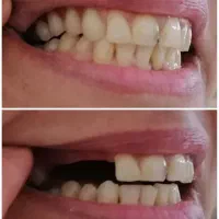 ت خفیف ویژه در طرح به زیبایی لبخند|آرایشی، بهداشتی، درمانی|یزد, |دیوار