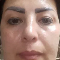 مراقبت پوستی|آرایشی، بهداشتی، درمانی|تهران, شهرک رضویه|دیوار