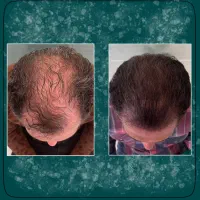 موهاتو توی سریع ترین حالت برگردون