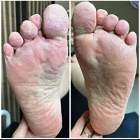 تخفیفات یلدایی به مناسب روز مادر و شب یلدا