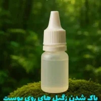 درمان زگیل تناسلی