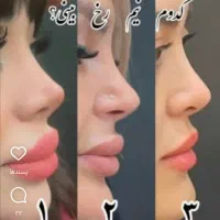عمل زیبایی اقساط بدون پیش پرداخت
