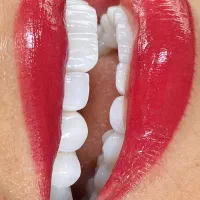 کامپوزیت|پزشکی|خرم‌آباد, |دیوار